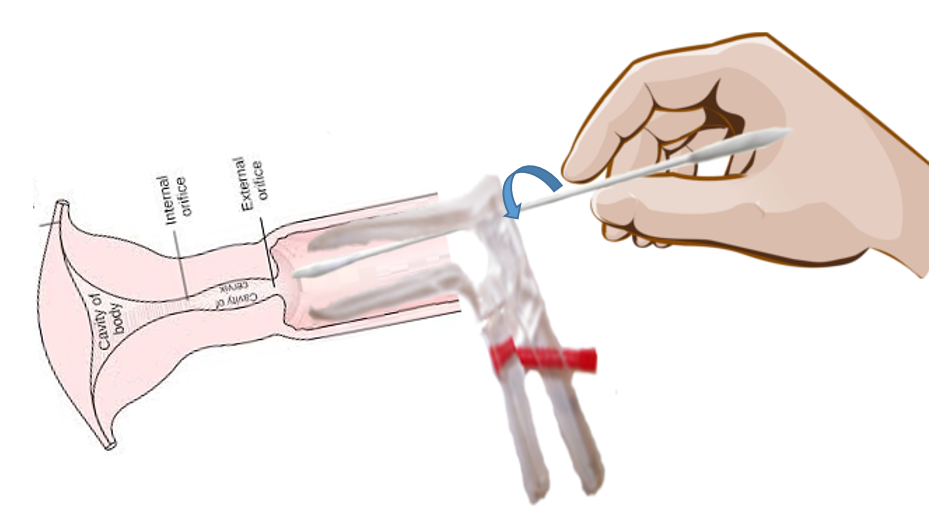 paptest Pap Test un esame rapido e semplice