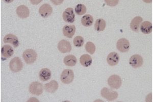 Parassiti Globulo rosso1